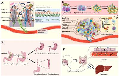 Systematic review on the role of the gut microbiota in tumors and their treatment